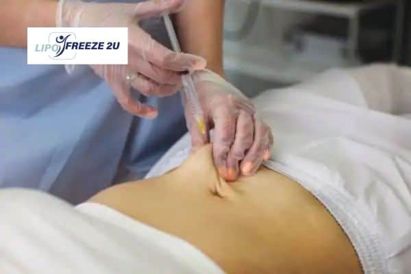 How Does Aqualyx Fat Dissolving Injection Work to Break Down Fat Edinburgh?