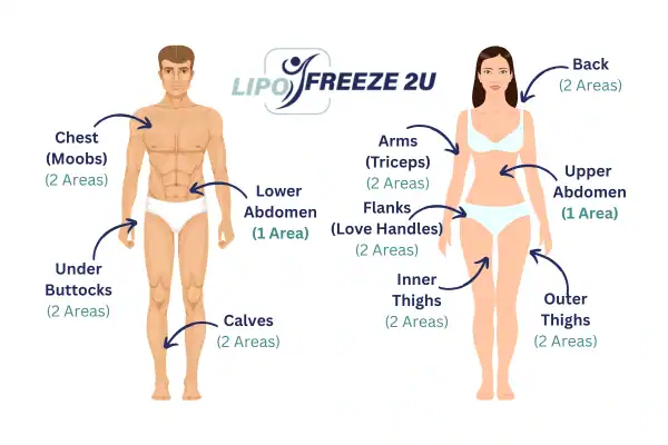 Areas you can have fat freezing treatment Edinburgh