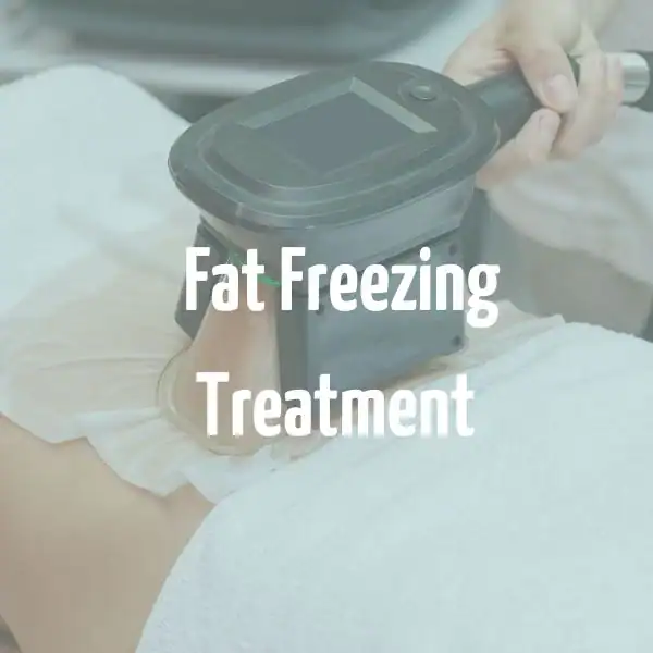 fat freezing treatment Edinburgh